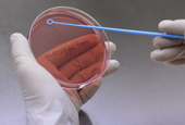العلماء يستخدمون طريقة البصمة الوراثية لاكتشاف بكتيريا الدوسنتاريا