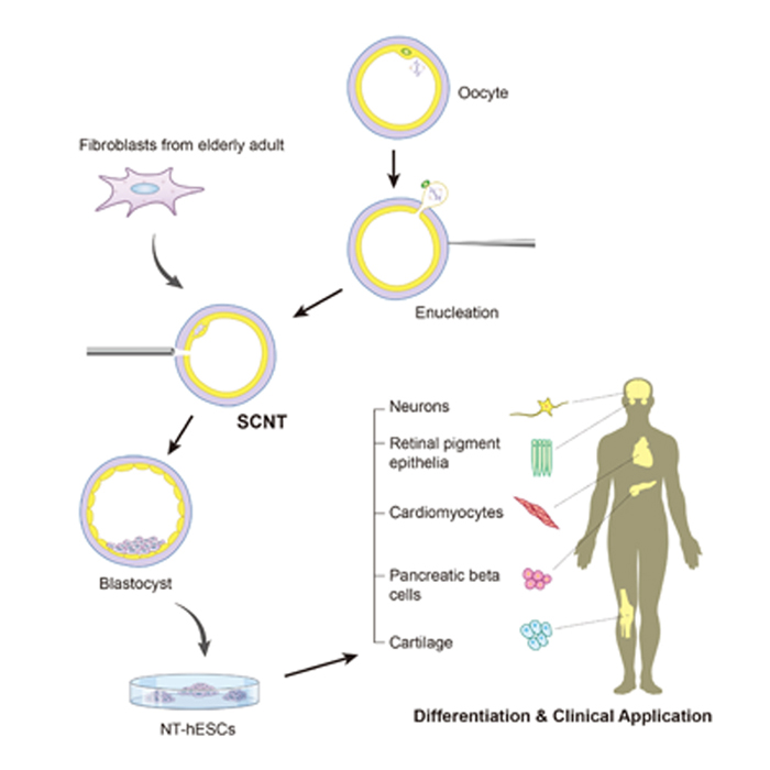 The process of producing and using somatic cell nuclear transfer (SCNT) methods to create embryonic stem cells for therapeutic purposes. (image courtesy of the CHA General Hospital Group)