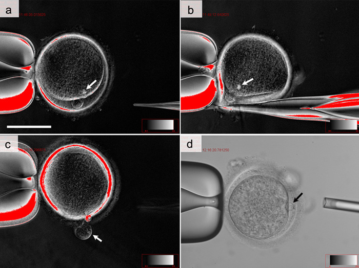 The steps involved during a somatic cell nuclear transfer (SCNT). (a) A human ovum. (b) The pellucid zone, located below an area containing the genetic material of the ovum, is incised using a knife pipette. The arrow points to the genetic material to be enucleated. (C) A cytoplasm containing genetic material from the ovum is eliminated using a knife pipette. (d) The nucleus of an adult male is inserted into an enucleated ovum. (images courtesy of the CHA General Hospital Group)